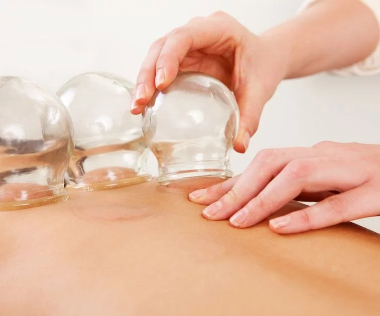 Artikelbild - Was bedeutet Schröpfen? (Traditionelle & Alternative Methoden) von herful